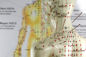 akupunkturpunkte hennef